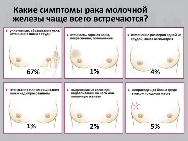 Как выполнить ремонт датчика углового поворота руля.